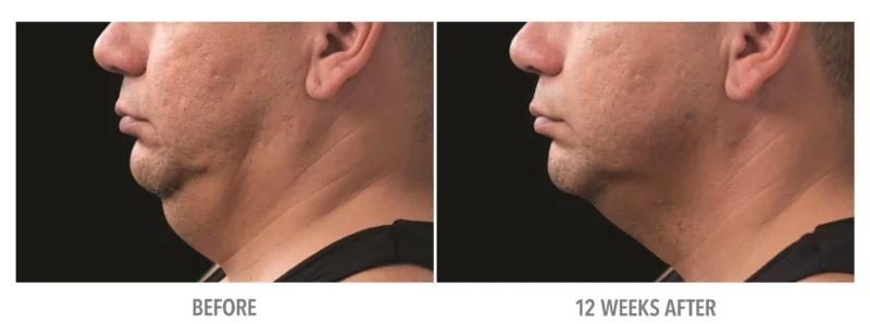 Neck